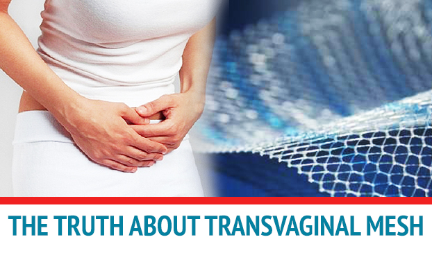Know The Basics, Complications And Settlements Linked To Transvaginal Mesh